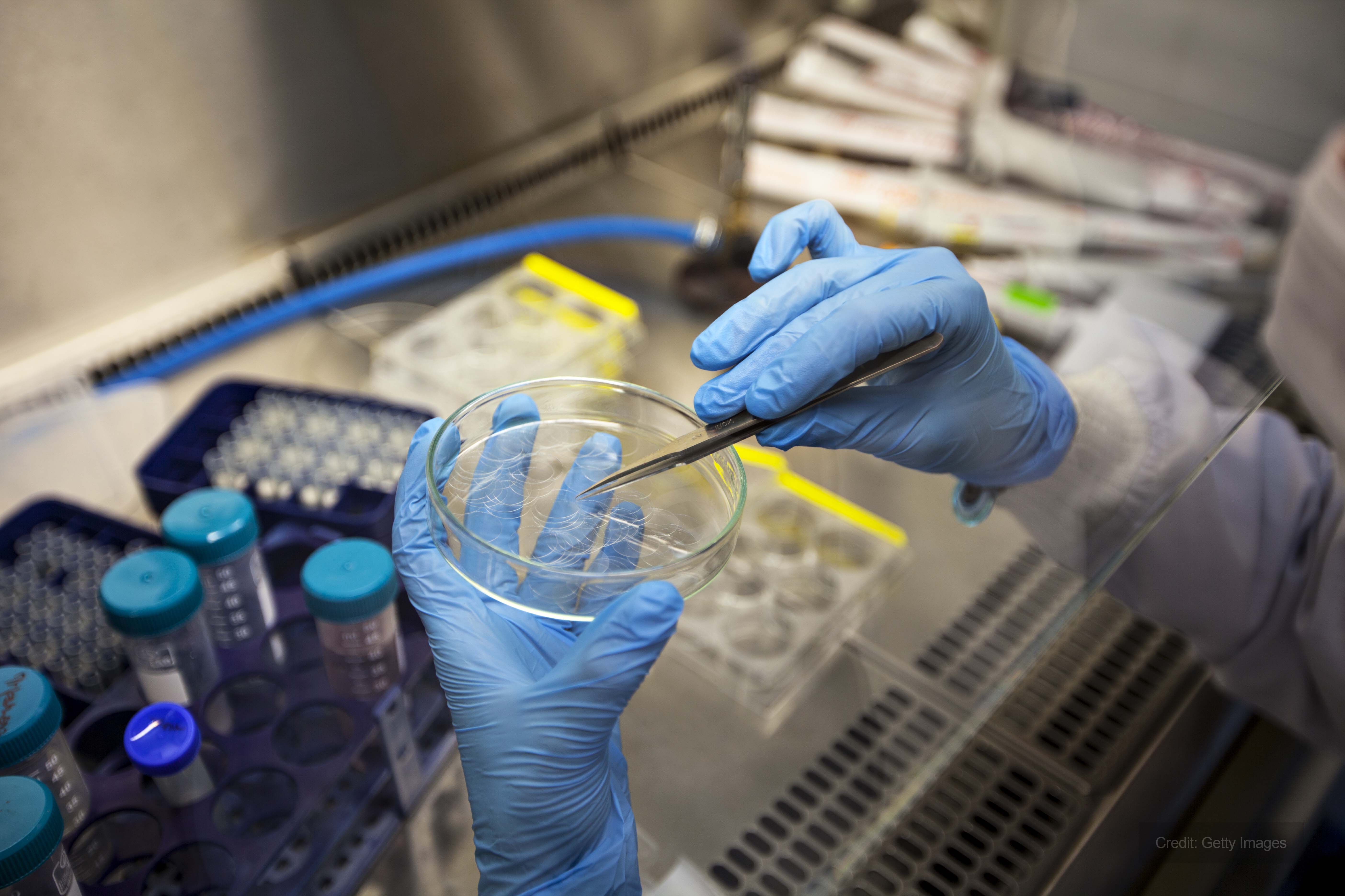 NHS stem cell laboratory requires temporary heating NHS stem cell laboratory requires temporary heating